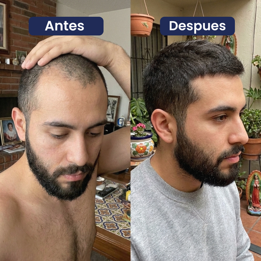 Reverso. Serum para el crecimiento del cabello